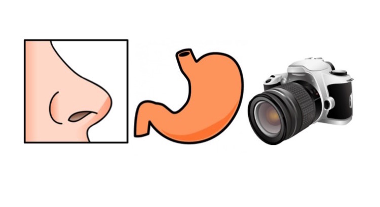 胃カメラ